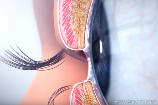 Meibomian Glands: Unlocking the Oil Glands for Healthy, Comfortable Eyes